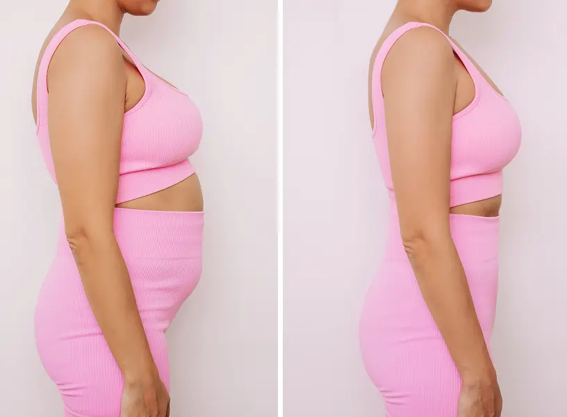 Результат трансформации 1